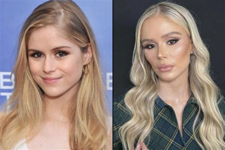 Haley Layne Plastic Surgery Before: Unveiling The Truth
