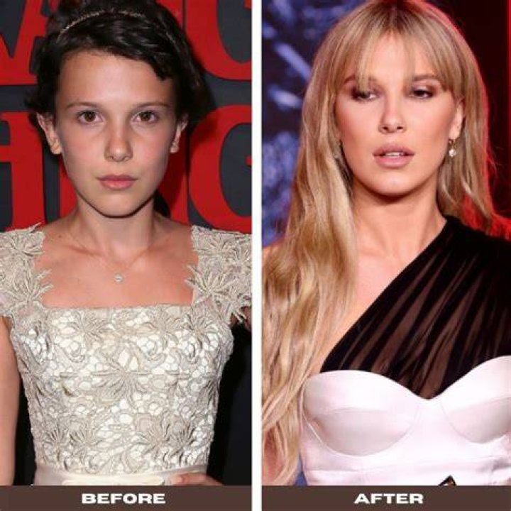 The Truth About Millie Bobby Brown's Plastic Surgery Rumors