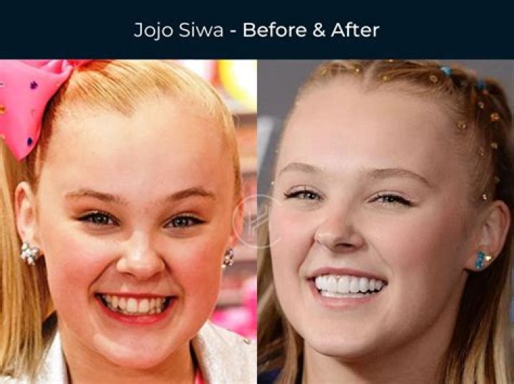 ZBlogS | JoJo Siwa